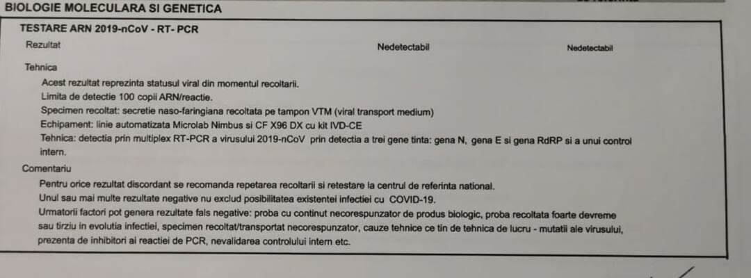 COVID test – Negative